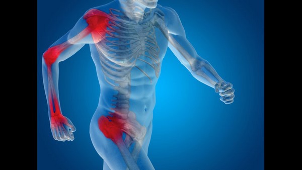  ಅವಾಸ್ಕುಲರ್ ನೆಕ್ರೋಸಿಸ್ ಎಂದರೆ ಏನು?