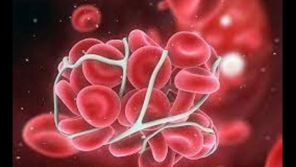  ರಕ್ತ ಹೆಪ್ಪುಗಟ್ಟುವ ಸಮಸ್ಯೆಯಿದ್ದವರಿಗೆ ಅಪಾಯ