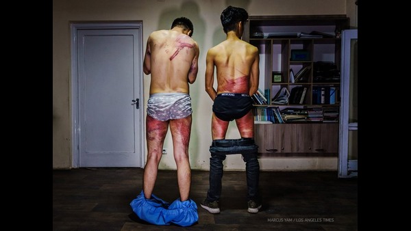 ತಾಲಿಬಾನ್ ಕ್ರೌರ್ಯಕ್ಕೆ ಸಾಕ್ಷಿ 