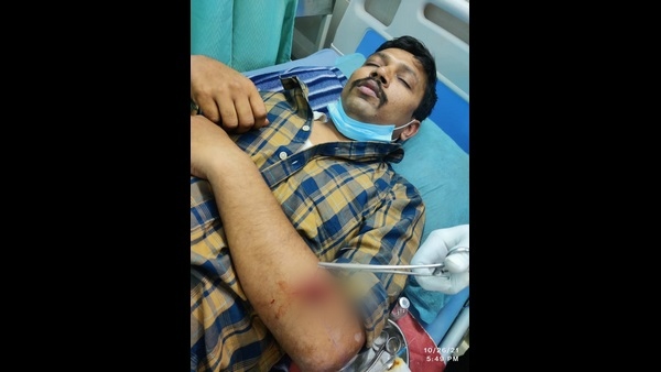 Bengaluru crime Roundup: Bike riders kills dog after disrupting wheeling 