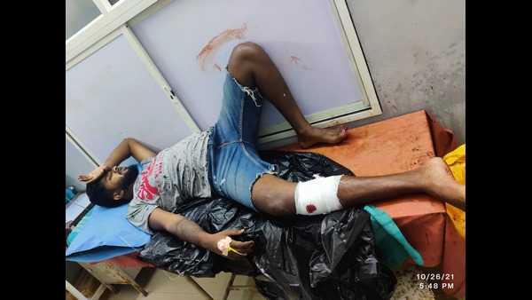 Bengaluru crime Roundup: Bike riders kills dog after disrupting wheeling 
