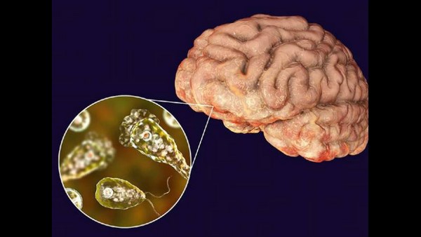 3 Year Old Boy Died By Brain Eating Microbe In Texas State 3 Year Old Boy Died By Brain Eating Microbe In Texas State