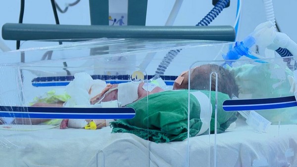 Mangaluru: Lady Goschen Hospital Launches Human Milk Bank