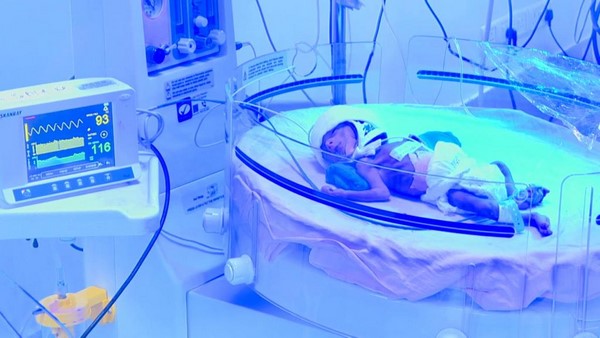 Mangaluru: Lady Goschen Hospital Launches Human Milk Bank