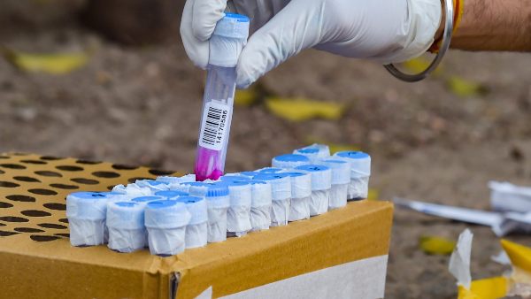  ಕಡಿಮೆ ತೀವ್ರತೆಗೆ ಕಾರಣವೇನು? 