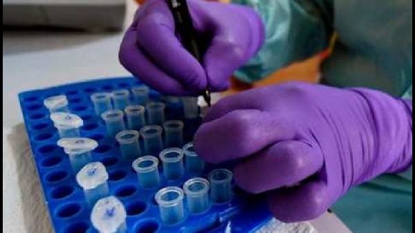 ಲಸ್ಸಾ ಜ್ವರದ ಕುರಿತು ಹೇಗೆ ಮುನ್ನೆಚ್ಚರಿಕೆ ವಹಿಸಬೇಕು? 