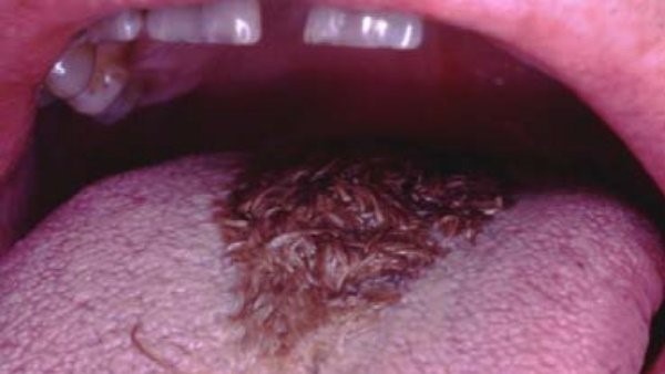 ವೈದ್ಯರು ಸಲಹೆ ಏನು? ವೈದ್ಯರು ಸಲಹೆ ಏನು?