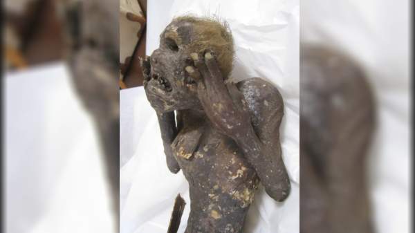 ದೇಹದ ಅರ್ಧ ಭಾಗ ಮನುಷ್ಯನಂತೆ