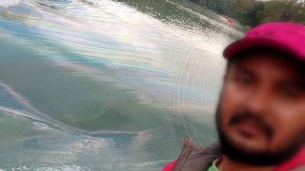 Acid attack on young woman in Bengaluru; Kamakshipalya Police Searching Psycho Lover