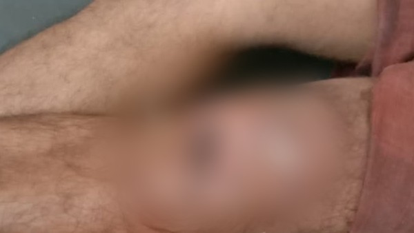 Nurse negligence: Mangaluru Man hospitalised