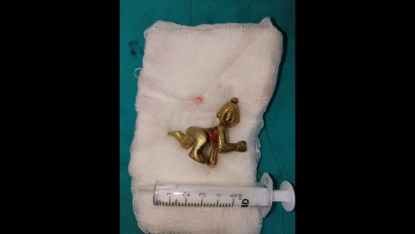 A Man Swallowed Krishna Idol With Holy Water In Belagavi Doctor Saves Him A Man Swallowed Krishna Idol With Holy Water In Belagavi Doctor Saves Him