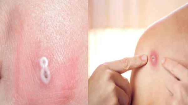  ಇಷ್ಟೊಂದು ರೂಪಾಂತರಿಗಳಾ?