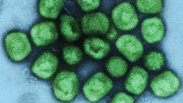 ಪ್ರಾಣಿಗಳಿಂದ ಅಲ್ಲ ಮನುಷ್ಯರಿಂದ ಮನುಷ್ಯರಿಗೆ ರೋಗ