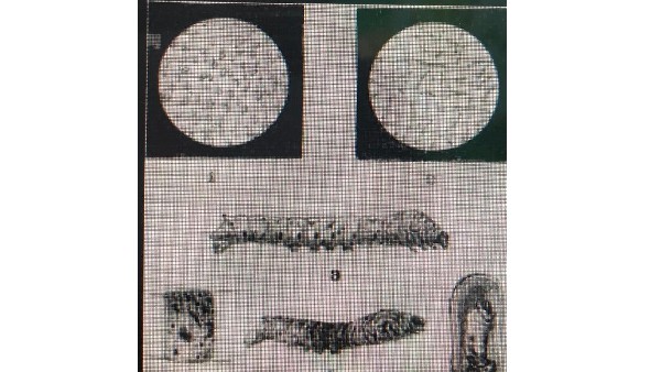  ಪೆಬ್ರಿನ್ ರೋಗ ನಿರ್ಲಕ್ಷ್ಯ ಬೇಡ