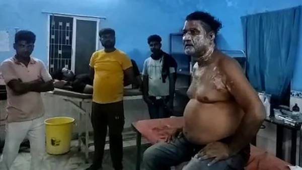 Pain due to mango: A person who got an acid attack after plucking a mango