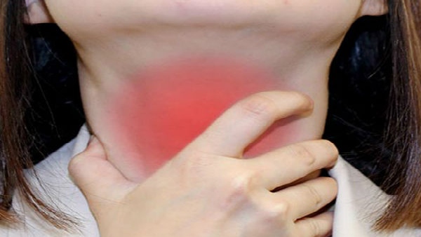  ಹವಾಮಾನದಲ್ಲಿನ ಬದಲಾವಣೆಗಳು ಕಾರಣ 