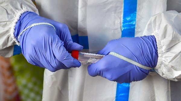 ಬುದ್ಧಿಮಾಂದ್ಯತೆ ಅಥವಾ ಪಾರ್ಶ್ವವಾಯು 