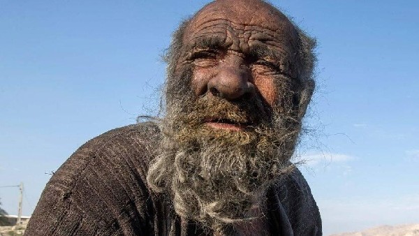  ಪ್ರಾಣಿಗಳ ಮಲದಿಂದ ಧೂಮಪಾನ ಮಾಡುವ ಚಟ