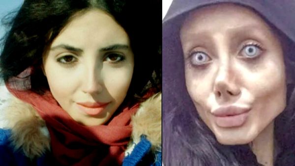 '50 ಕಾಸ್ಮೆಟಿಕ್ ಶಸ್ತ್ರಚಿಕಿತ್ಸೆ ಮಾಡಿಸಿಕೊಂಡಿಲ್ಲ'