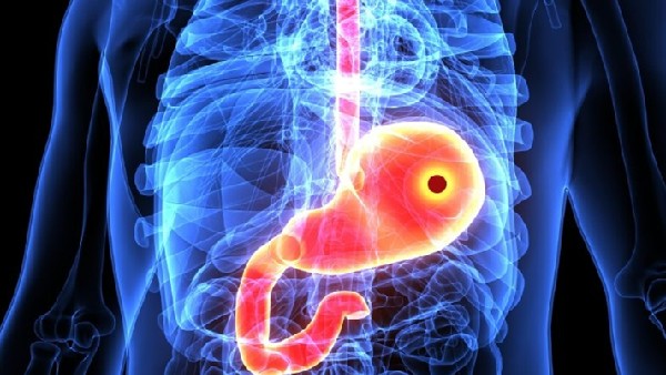 ರಾತ್ರಿ ಪಾಳಿಯಿಂದ ಜೀರ್ಣಾಂಗ ಕ್ರಿಯೆಗೆ ತೊಂದರೆ