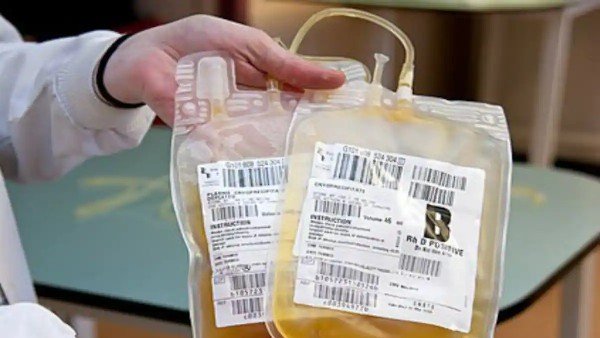 ರಕ್ತದ ಬದಲು 'ಮೋಸಂಬಿ ಜ್ಯೂಸ್' 