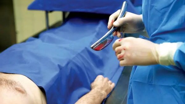 Snake came out of the dead body during the postmortem examination