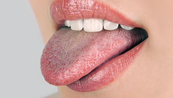 Burnt tongue while eating hot food? Try this grandmas remedy...