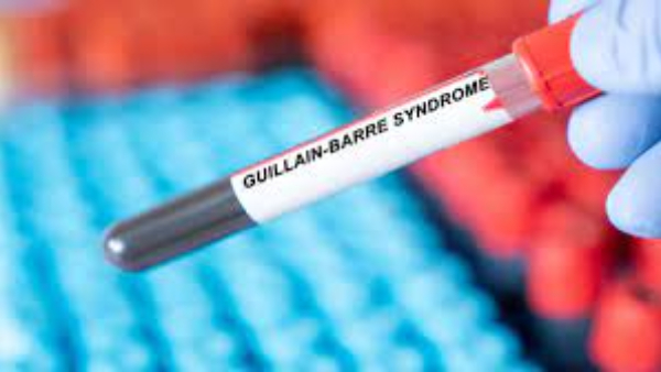 Guillain-Barre Syndrome: Peru Declares Health Emergency as Guillain-Barré Syndrome Cases Surge 