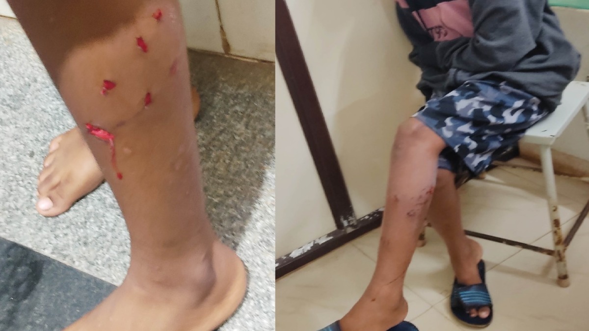 Mad dog attacks in Periyapatna