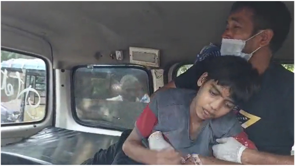 Teen Boy Tragically Dies of Rabies in Ghaziabad After Keeping Dog Bite a Secret