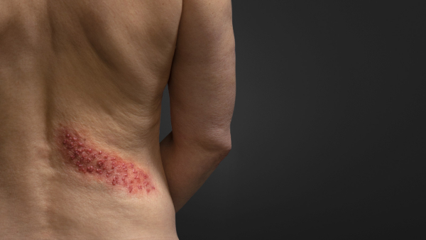 In Bengaluru Only 12 Percent Vaccinated Against Adult Disease: API-Ipsos Survey Reveals