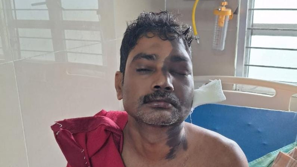 Acid Attack On Owner After Dog Barking At NR Pura 