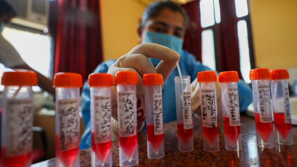 Four New Coronavirus Case Found In Chikkamagaluru In One Day 