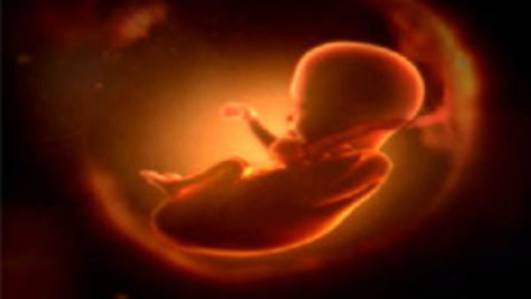 Two Doctors Have Been Suspended After A Loophole Was Found In The Case Of Feticide 