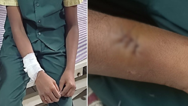 Boy Thrashed By Teacher With Rod For Not Doing Homework