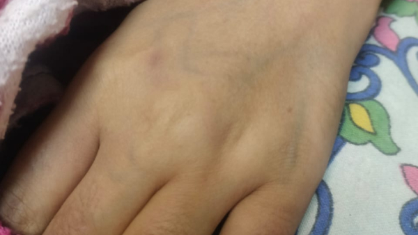 Woman Found Dead At Mudigere Murder Allegation Against Husband