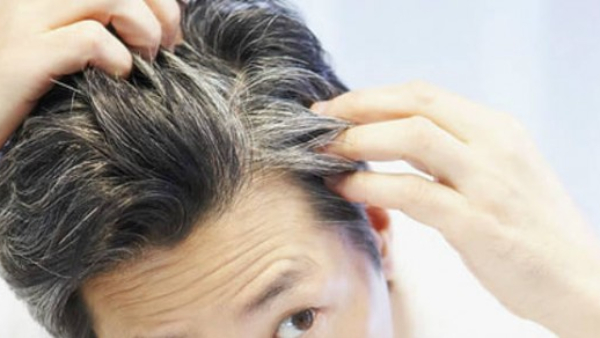 Follow these tips for 9 days to turn your grey hair to black hair permanently in Kannada