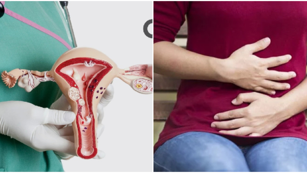 Cervical Cancer: What Are The Symptoms Women Need To Watch Out For?