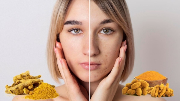 Here is The Best Home Remedies For Glowing Skin, details