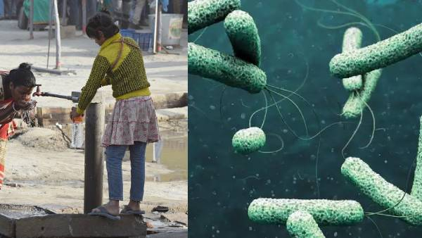 Cholera Disease Spike in Bengaluru One Positive Cases Detected in Malleswaram Know Details