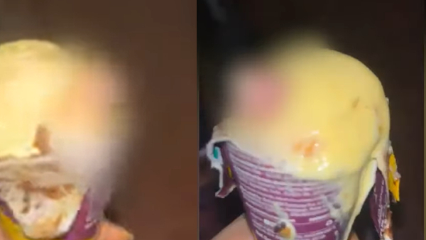 Human Thumb In Ice Cream DNA Test Reveals finger belonged to Factory Worker Human Thumb In Ice Cream DNA Test Reveals finger belonged to Factory Worker