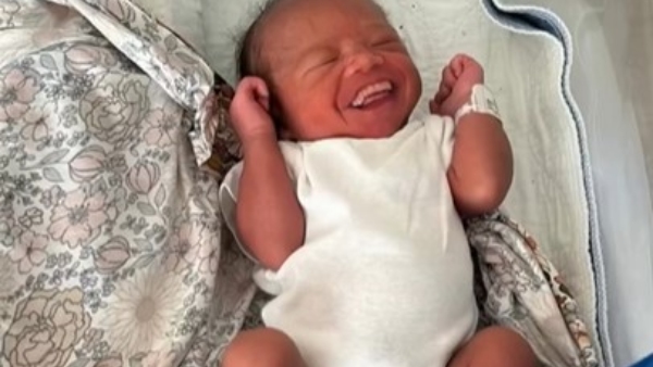 A Rare child born with 32 teeth video Viral