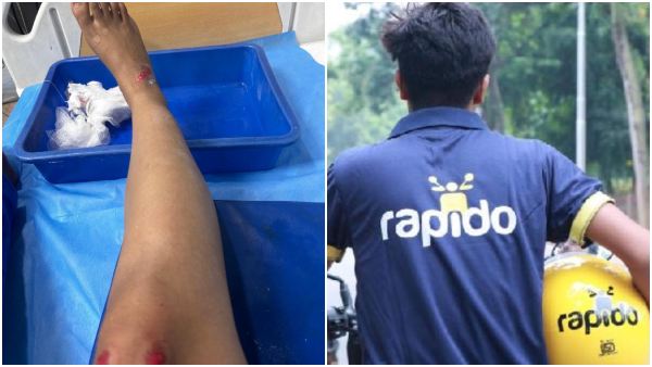 Google Employee Injured Due to Rapido Driver s Rash Driving in Bengaluru