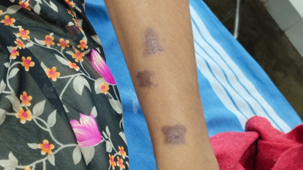 Vijayapura District Tikota Police Assault On His Wife