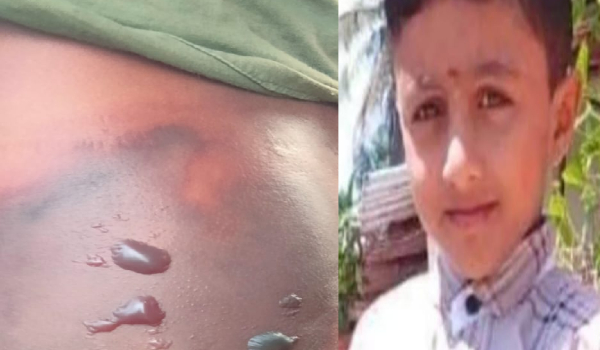 7-year-old boy died due to an overdose injection in Chikkamagaluru