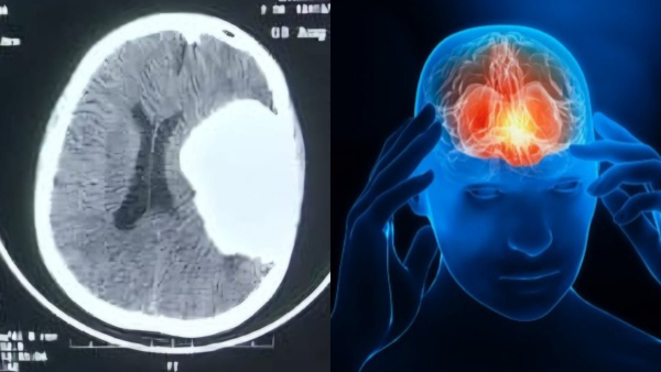 Hubballi Balaji Hospital Doctors Succeeded In Removing A Huge Tumor Hubballi Balaji Hospital Doctors Succeeded In Removing A Huge Tumor