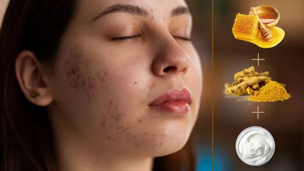 Skin Care Tips Benefits of Using Turmeric with These Ingredients on face