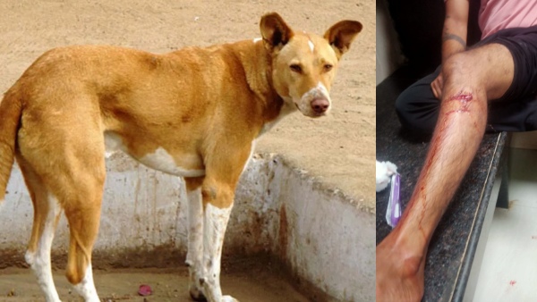 Street Dog Attack on 20 People and Bite Their Legs All Admitted to Kims in Hubballi Street Dog Attack on 20 People and Bite Their Legs All Admitted to Kims in Hubballi
