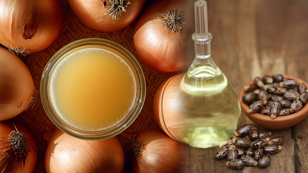 onion juice benefits for hair know here how to use it