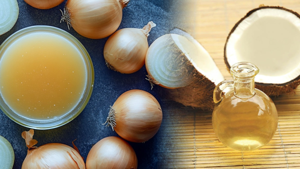 onion juice benefits for hair know here how to use it